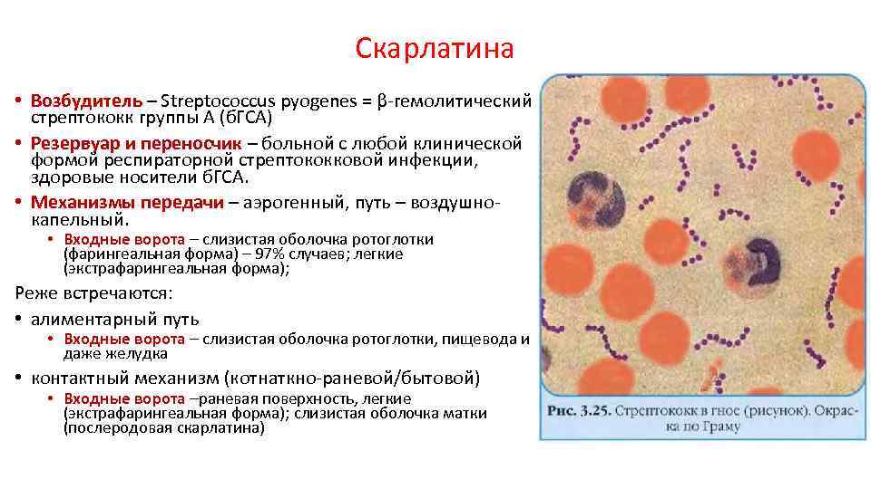 Стрептококковая инфекция у детей - симптомы болезни, профилактика и лечение стрептококковой инфекции у детей, причины заболевания и его диагностика на eurolab