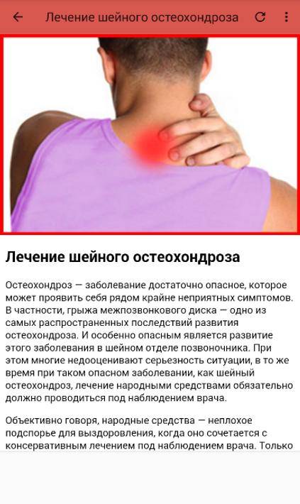 Обострение шейного остеохондроза лечение в домашних. Боли при остеохондрозе шейного. Симптомы при шейном остеохондрозе. Что болит при шейном остеохондрозе. Боли в шейном остеохондрозе.