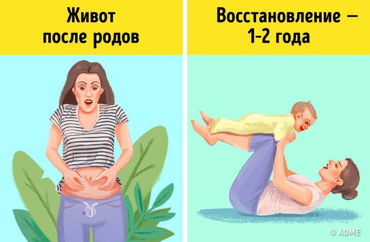 Восстановление после родов