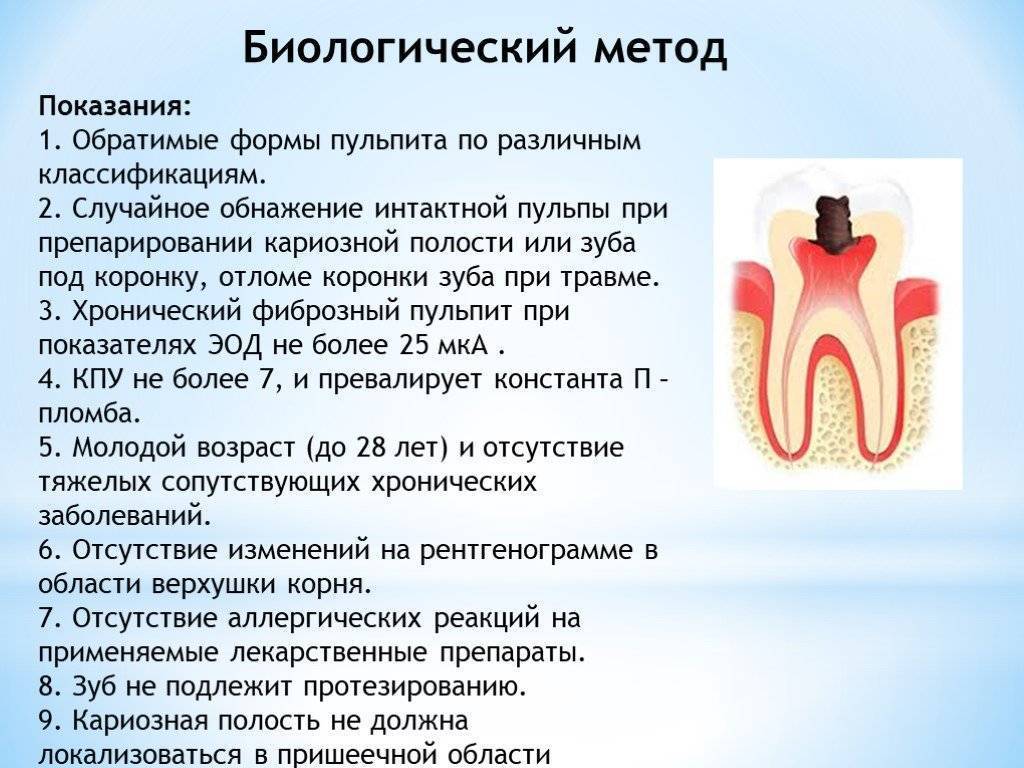 Лечение периодонтита постоянных и молочных зубов