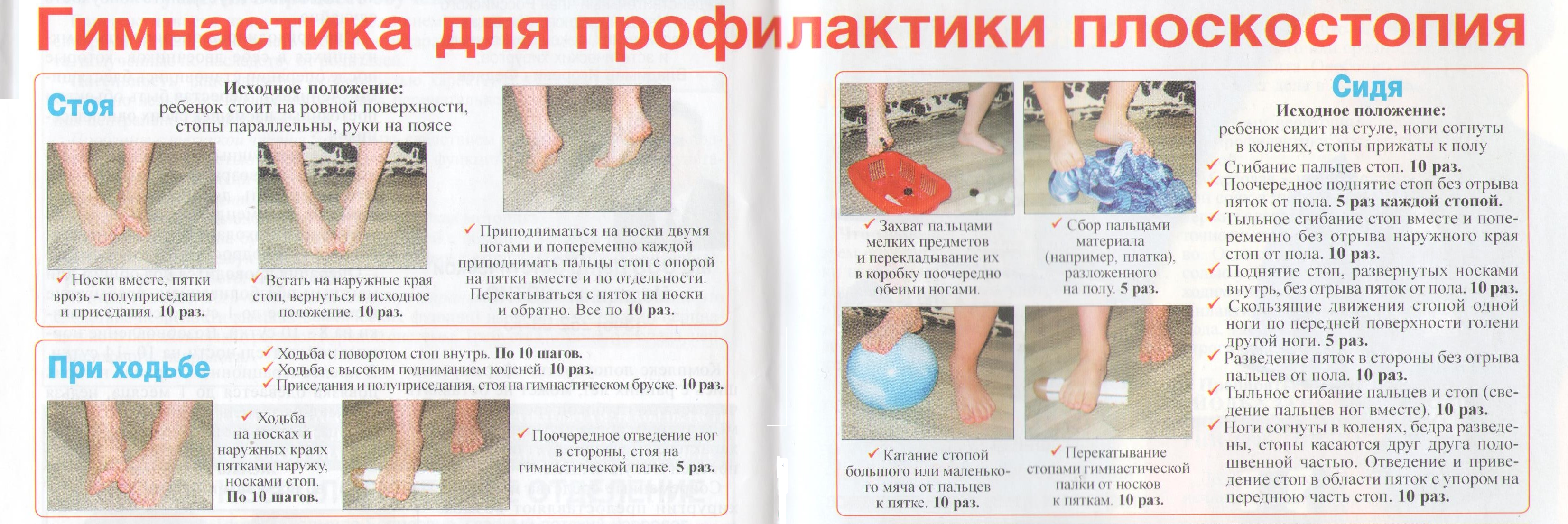Комплекс упражнений для стоп при вальгусной деформации у ребенка