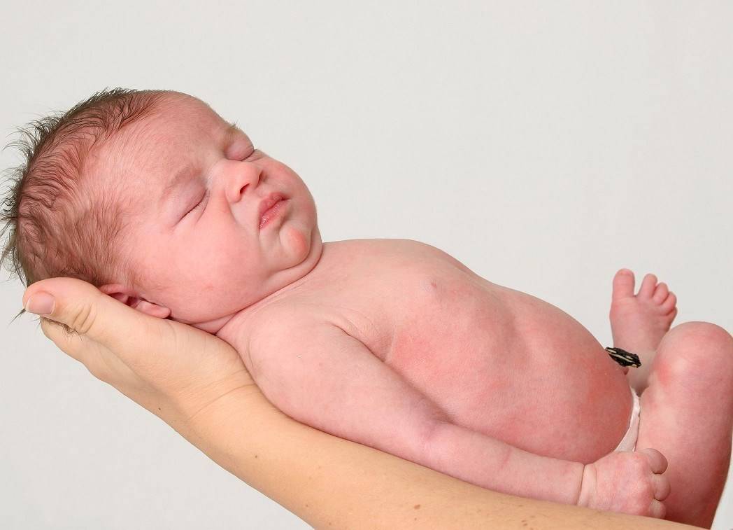 Если кровит пупок у новорожденного: 3 основных правила обработки пупочной ранки от неотнатолога