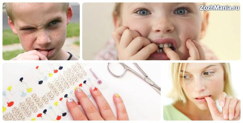 Ребёнок грызёт ногти как отучить и причины: советы психолога, фото