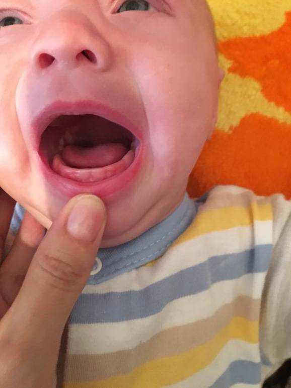 Грудничок все время сосет кулак, слюни текут пузырями: выясняем причины обильного слюноотделения у ребенка в 2-3 месяца