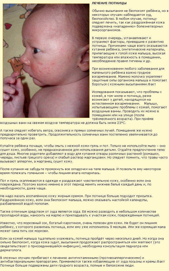 Потница у ребенка: симптомы и лечение | фото потницы у детей