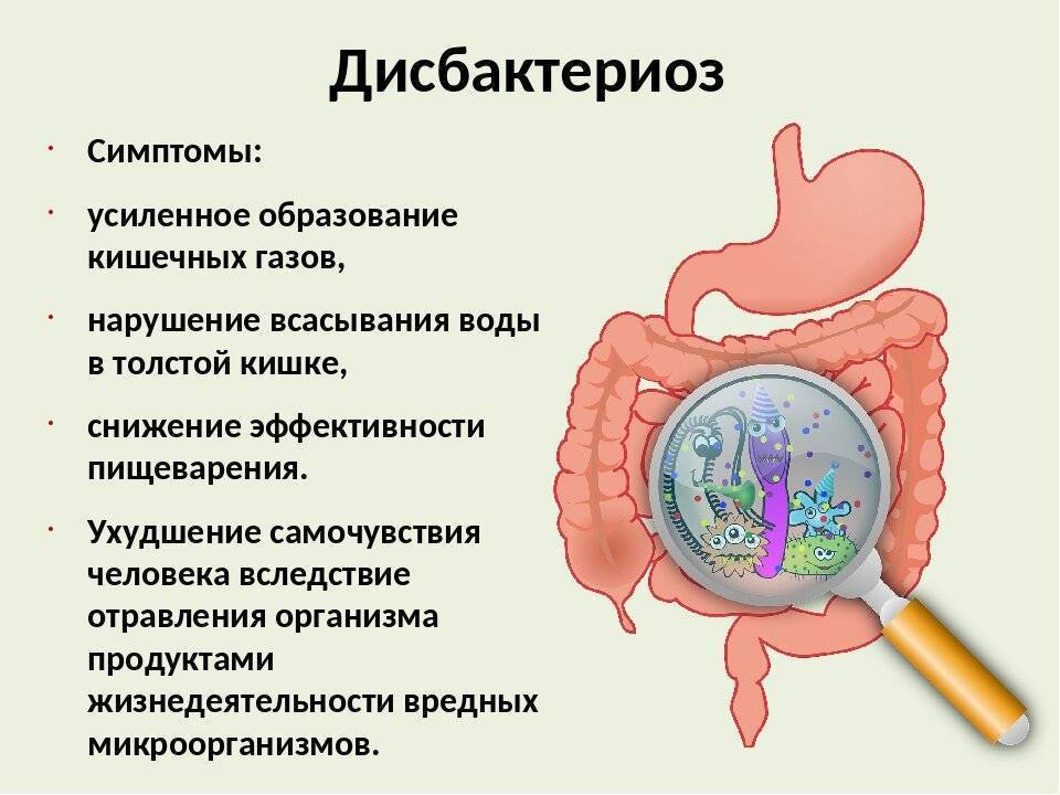Дисбактериоз у грудничка: симптомы и лечение нарушения микрофлоры кишечника
