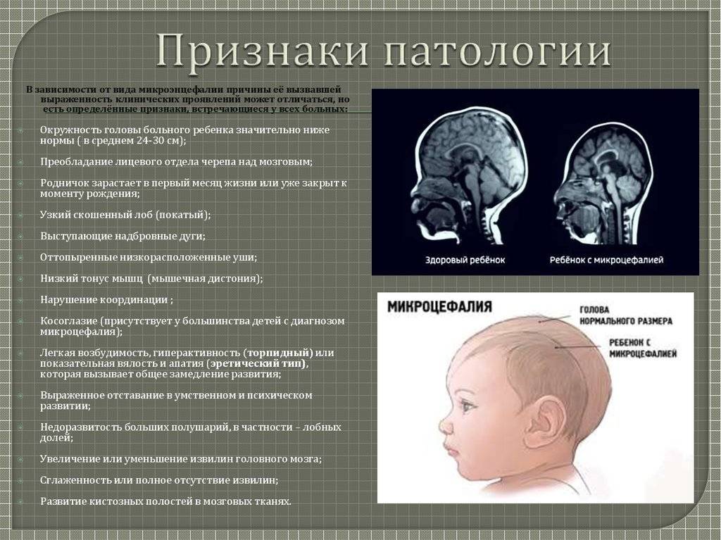 Детская эпилептология (разина е.е.)