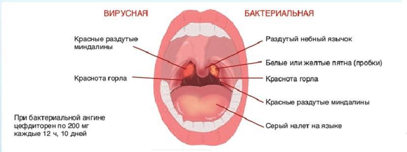 Во рту температура без