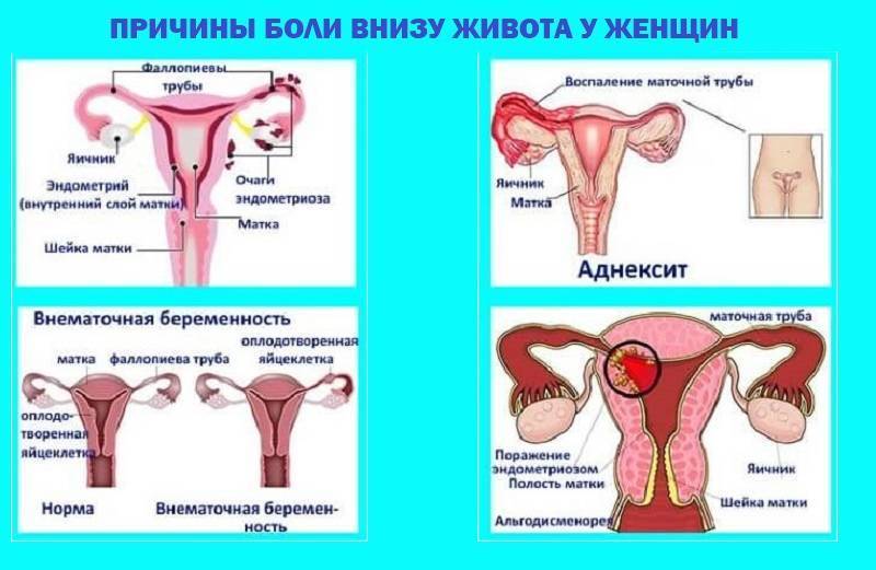 Почему болит голова перед месячными и во время месячных: причины менструальных мигреней | ким