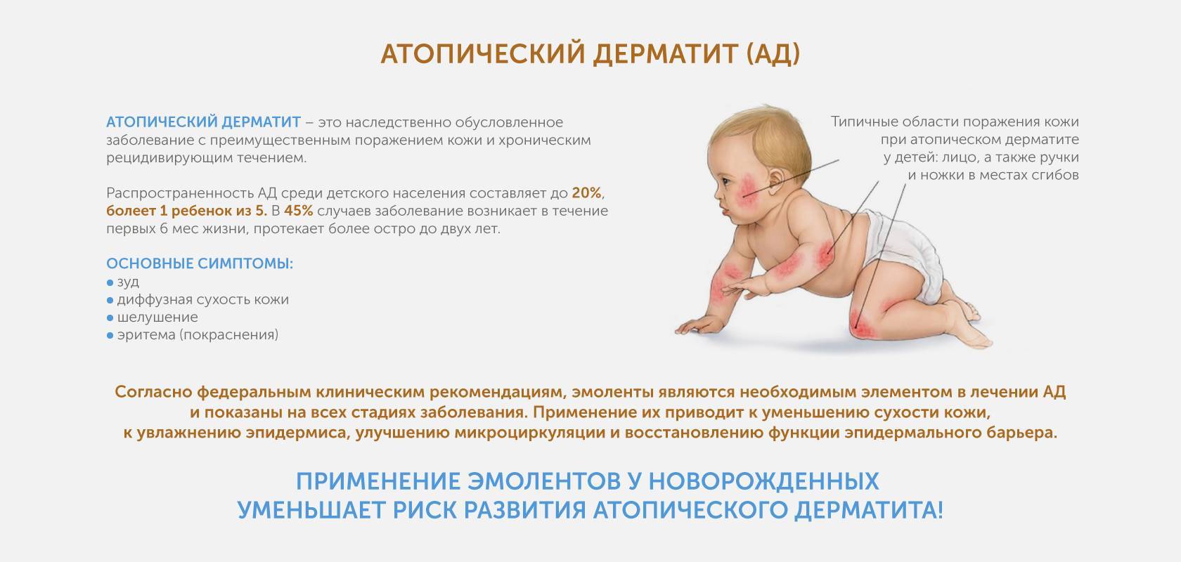 Мдоу «детский сад  №144». атопический (аллергический) дерматит у ребенка. симптомы и лечение