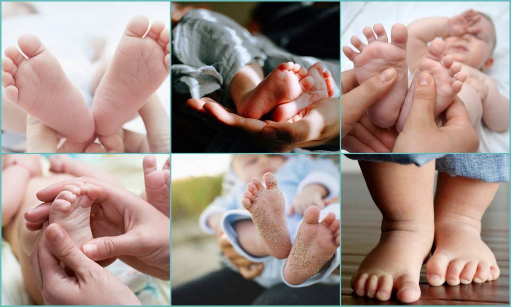 Почему потеет ребенок 4 лет. Ножки новорожденного. Гипергидроз стопы у детей. Гипергидроз ладоней и стоп у детей.