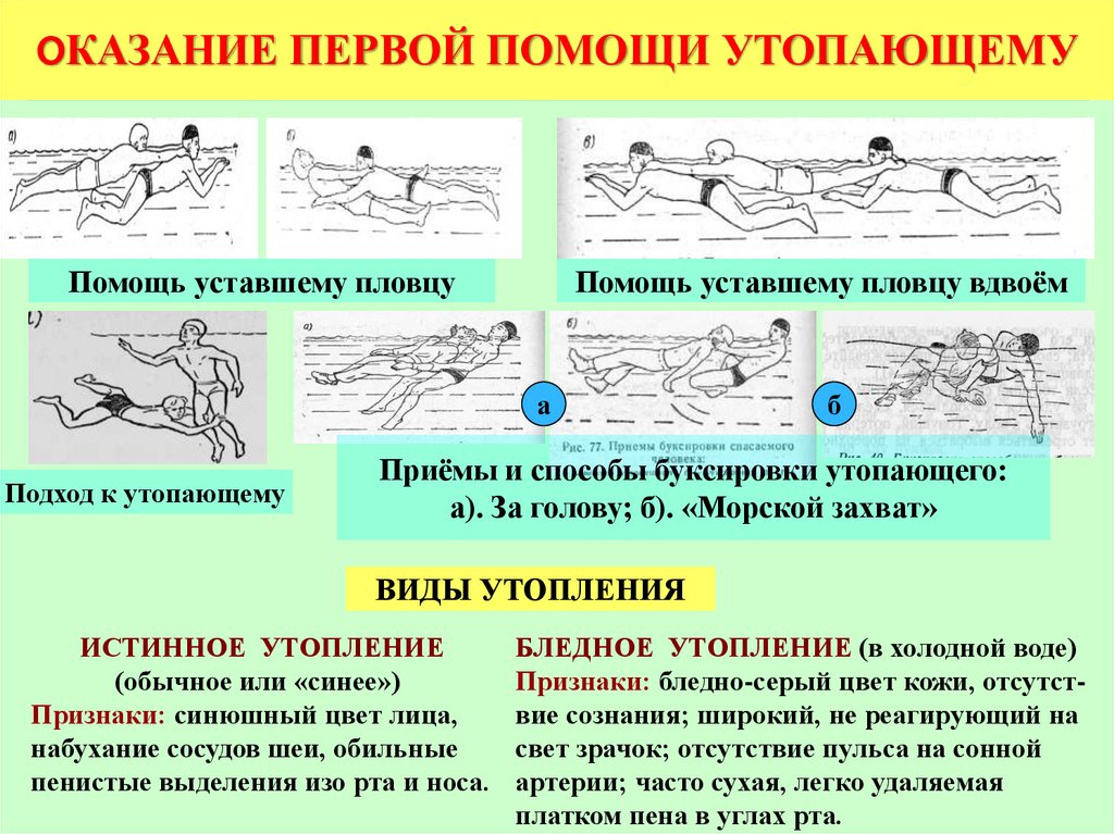 Утопление. причины и механизм развития патологического состояния. виды утоплений. правила оказания неотложной и медицинской помощи. осложнения, последствия и профилактика утоплений