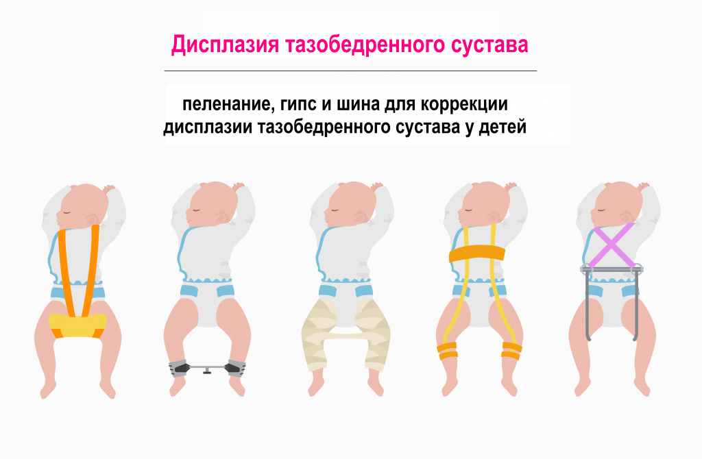 Узи врожденная дисплазия тазобедренных суставов (лекция на диагностере) - диагностер