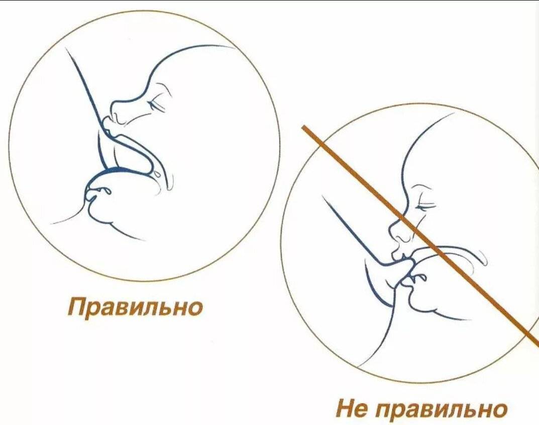 Выплевывает сосок. Правильное прикладывание при кормлении грудью. Правильное прикладывание новорожденного ребенка к груди. Правильный захват при грудном вскармливании новорожденного ребенка. Правильное прикладывание ребенка при грудном вскармливании.