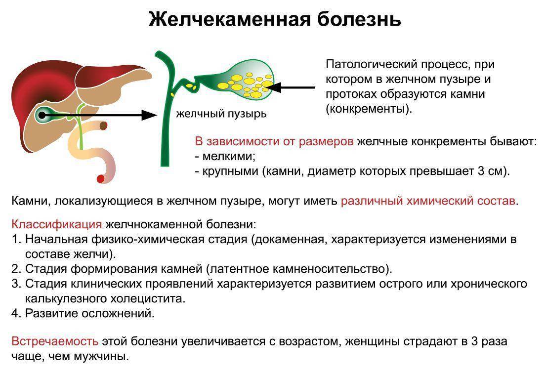 Схема лечения желчного пузыря