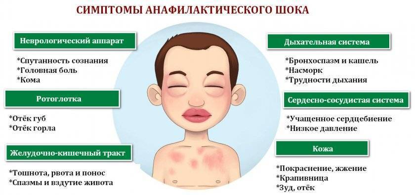 Аллергия у детей – причины, симптомы и лечение аллергии на коже у ребенка