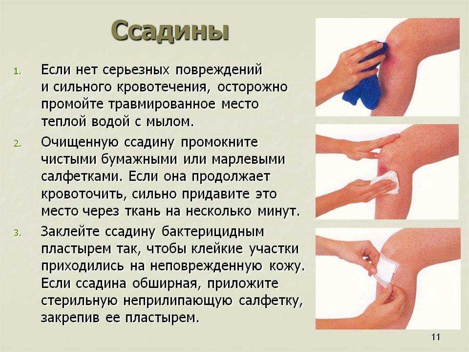 Ссадины на коленях у детей: чем лечить?