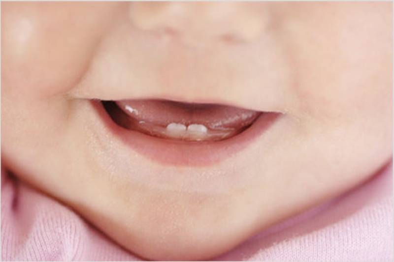 Глазные зубы у детей