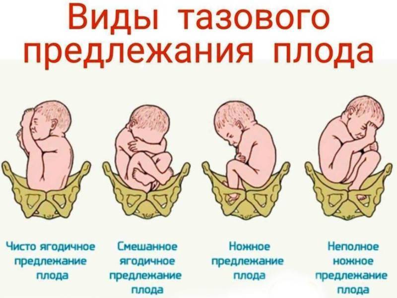Как понять, что ребенок опустился в малый таз и головка прижата ко входу, когда будут роды и какой перед ними аппетит?