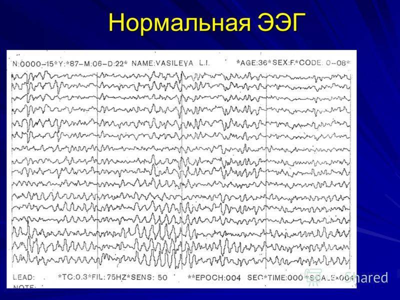 Ээг картинка для презентации