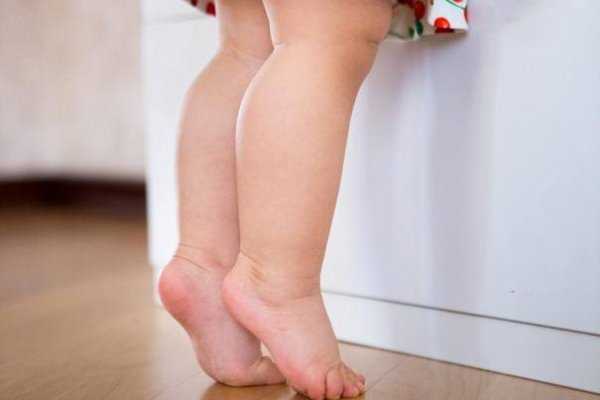 Ребенок в год ходит на носочках причины