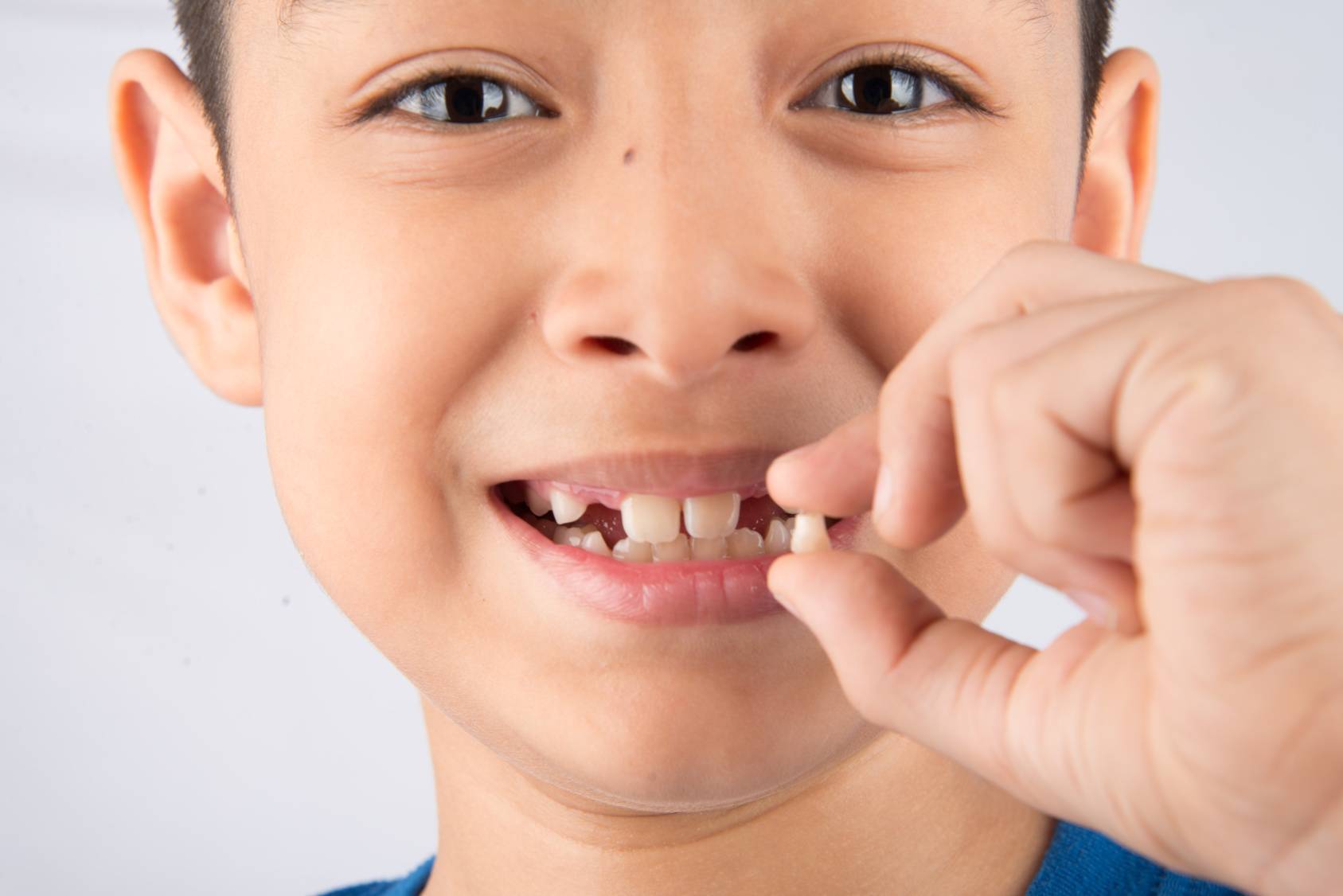 Зубы человека у детей. Молочные зубы кт ребенка. Выпадение молочных зубов.