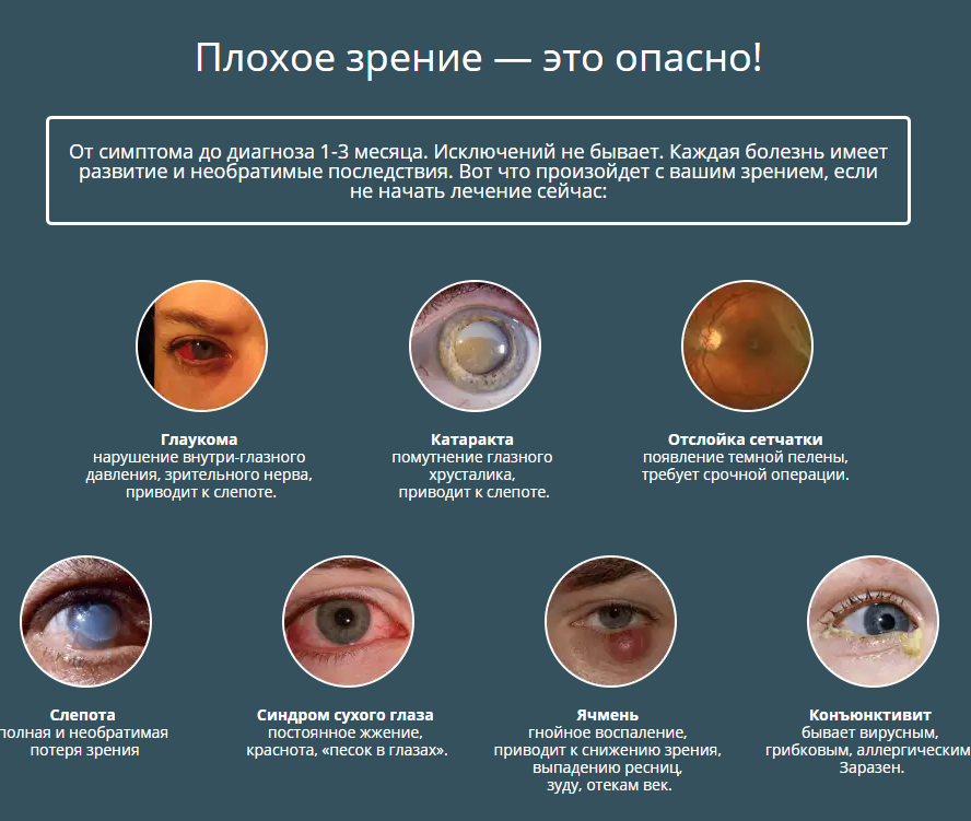 Болезни зрения и глаз у детей - список, виды, причины, симптомы, лечение