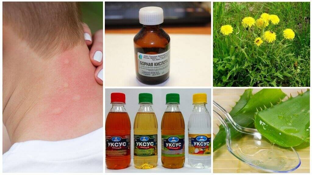 Лучшие лекарства от аллергии: топ эффективных препаратов для лечения аллергии