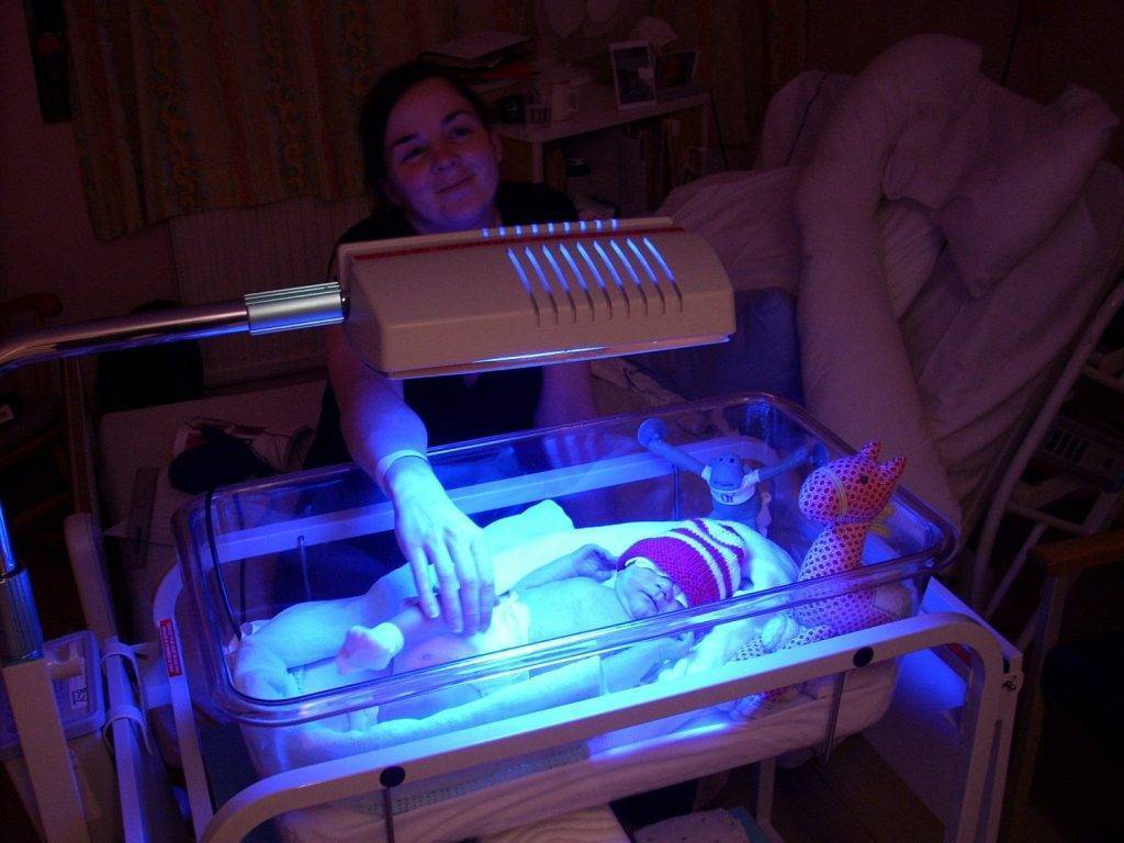 Фототерапия при желтухе у новорожденных