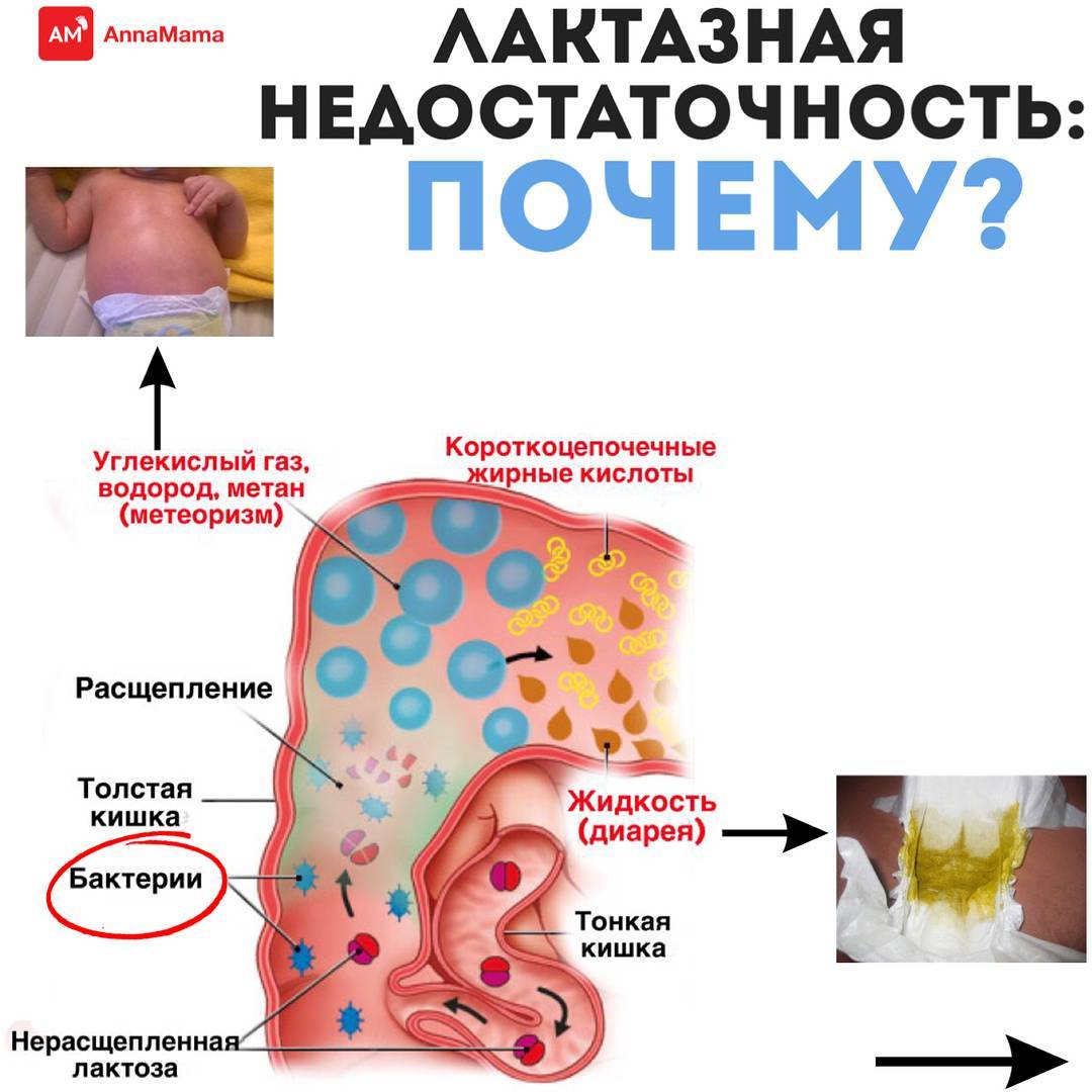 Грудное вскармливание. лактазная недостаточность. мамин блог