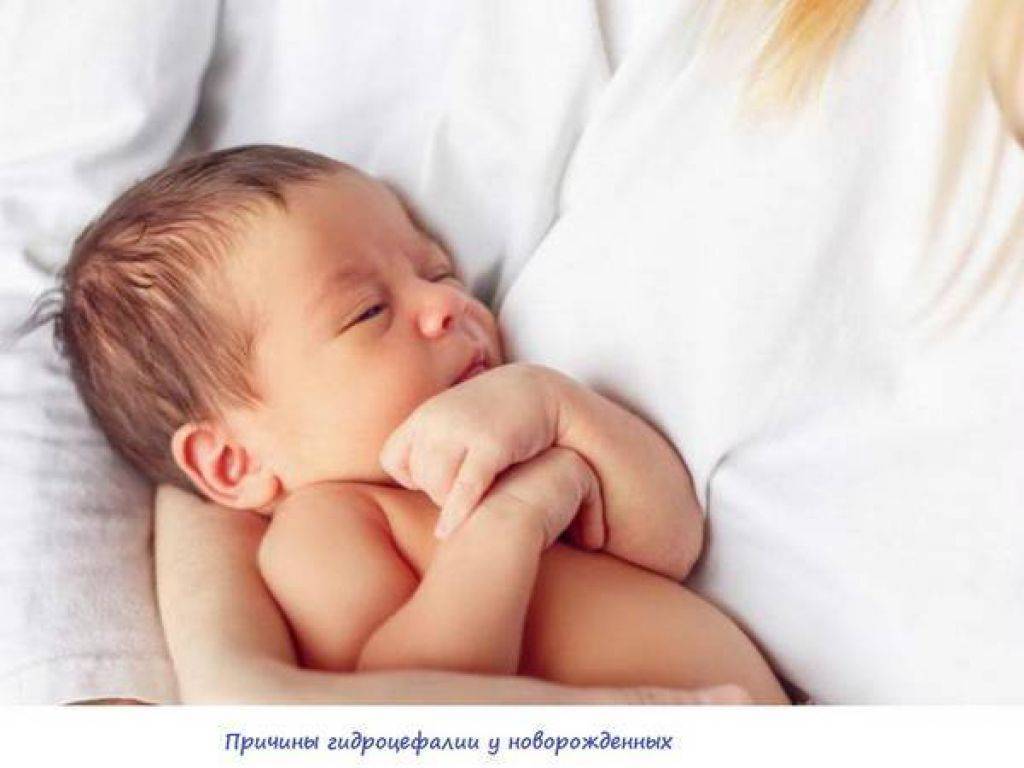 У ребенка потеет голова во время сна