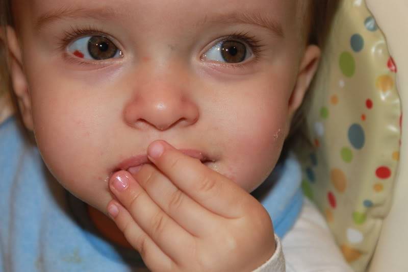 Конъюнктивит ребенка 6 лет. Глаз красный у новорождённых. Красное пятно в глазу у ребенка. Глаза ребенка.