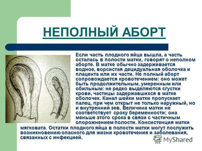 Здоровье после аборта — гормональный фон, инфекции и депрессия