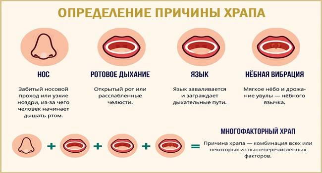 Вред храпа. симптомы и последствия осложненного храпа | buzunov.ru