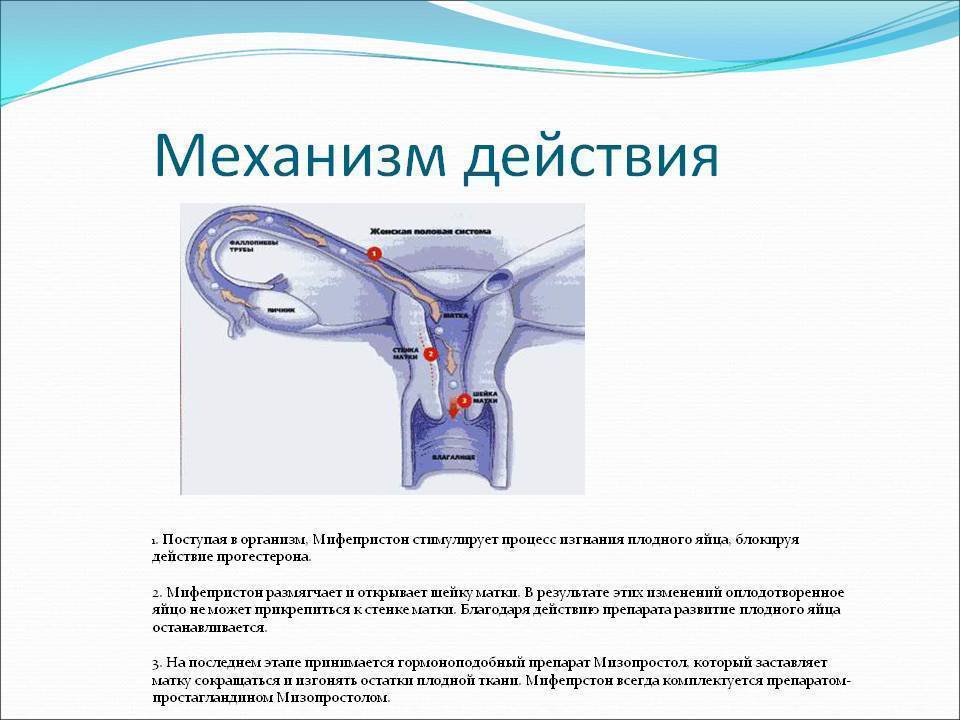 Миропристон: препарат для экстренной контрацепции при беременности до 6 недель