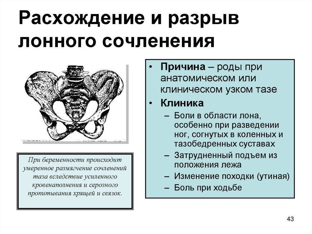 Перекос таза - лечение, симптомы, причины, диагностика | центр дикуля