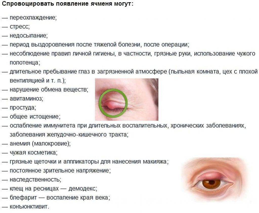 Быстрое лечение ячменя на глазу у детей - препараты, фото и комаровский