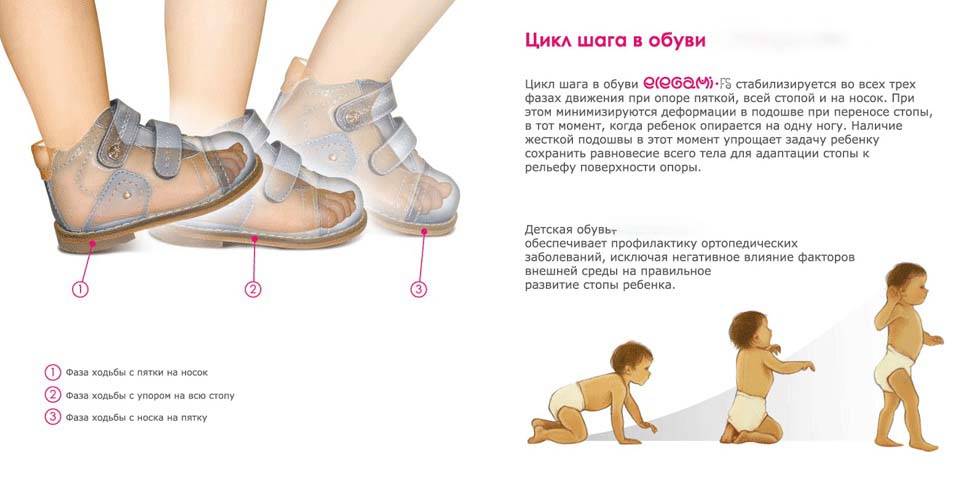 Почему ребенок ходит на цыпочках в 2-3 года (на носочках): комаровский