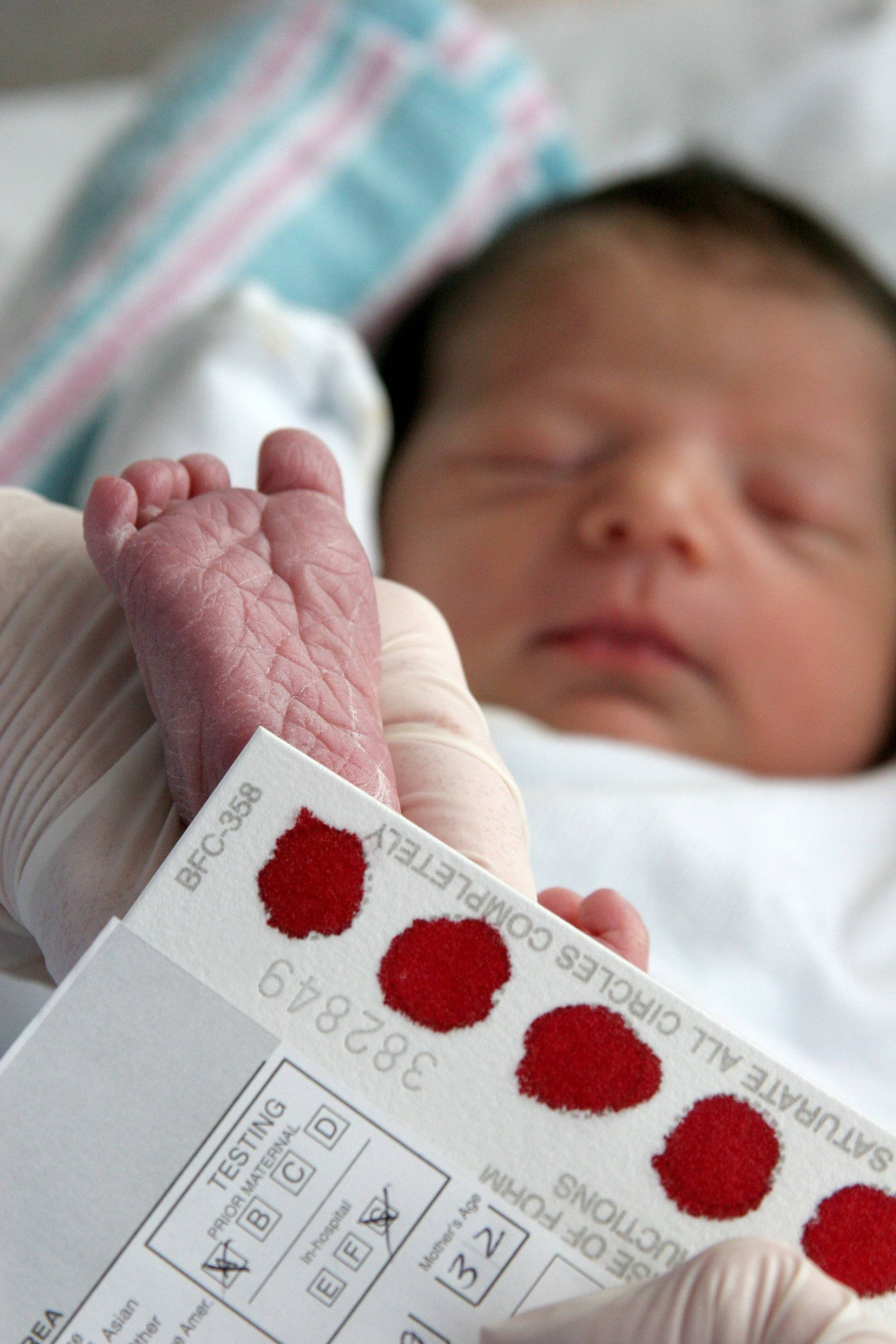 Какие анализы берут у новорожденных в роддоме и зачем