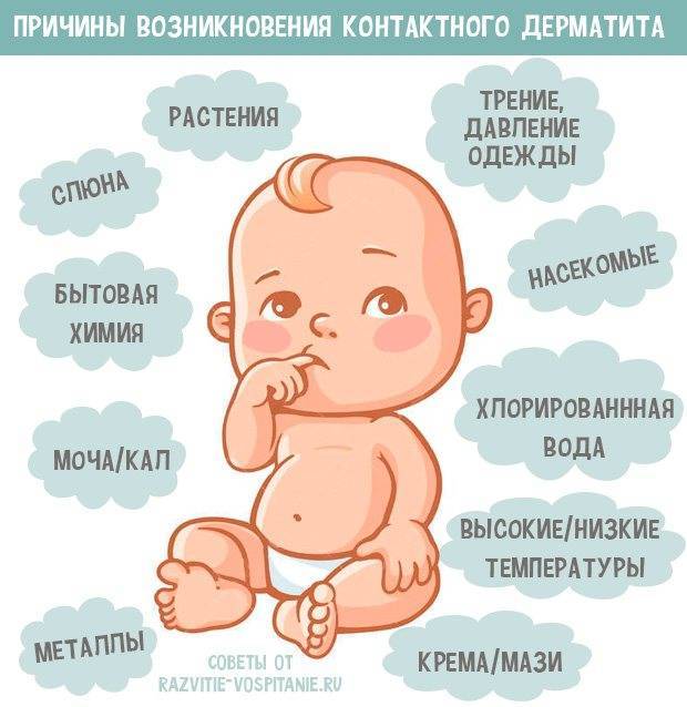 Опрелости у новорожденных детей: чем лечить, причины появления и профилактика
