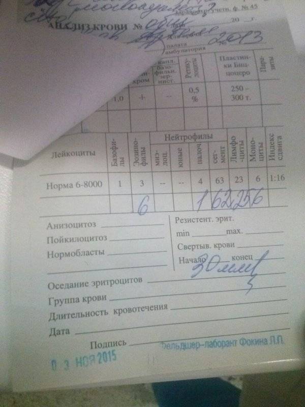 Мононуклеоз у детей