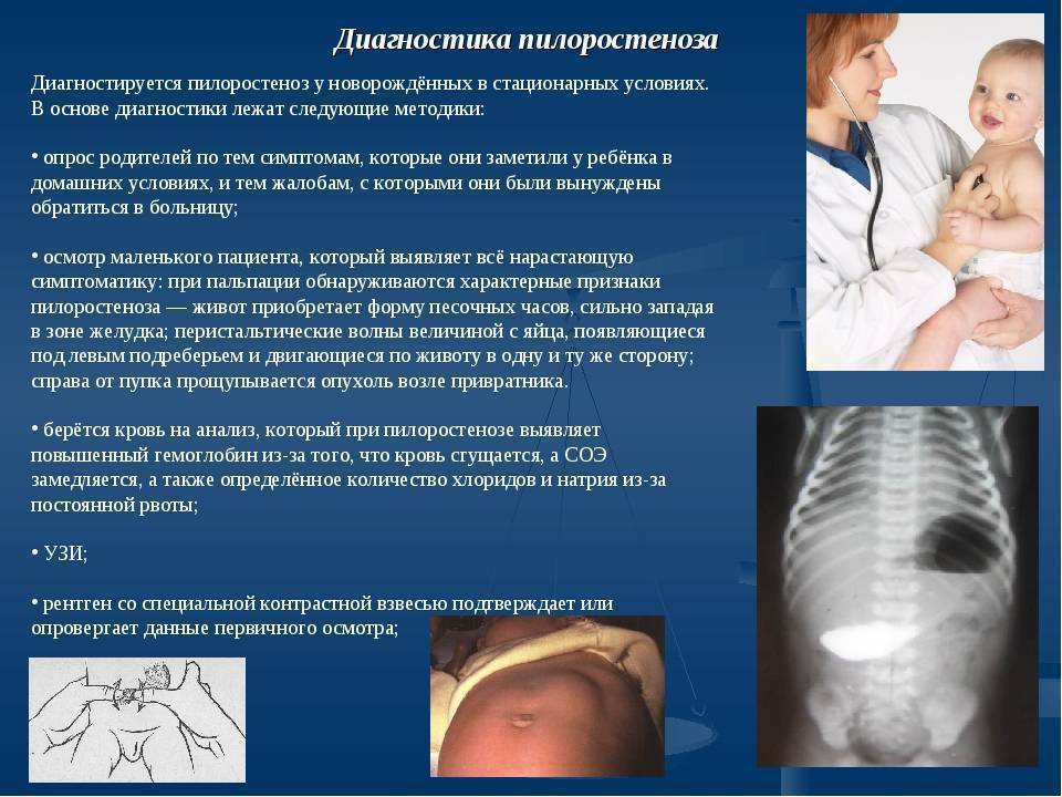 Омикрон у детей