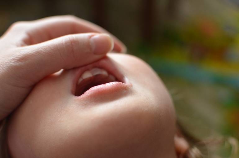 Ребенок ударился челюстью, зуб потемнел и на десне образовалась гематома: что делать?