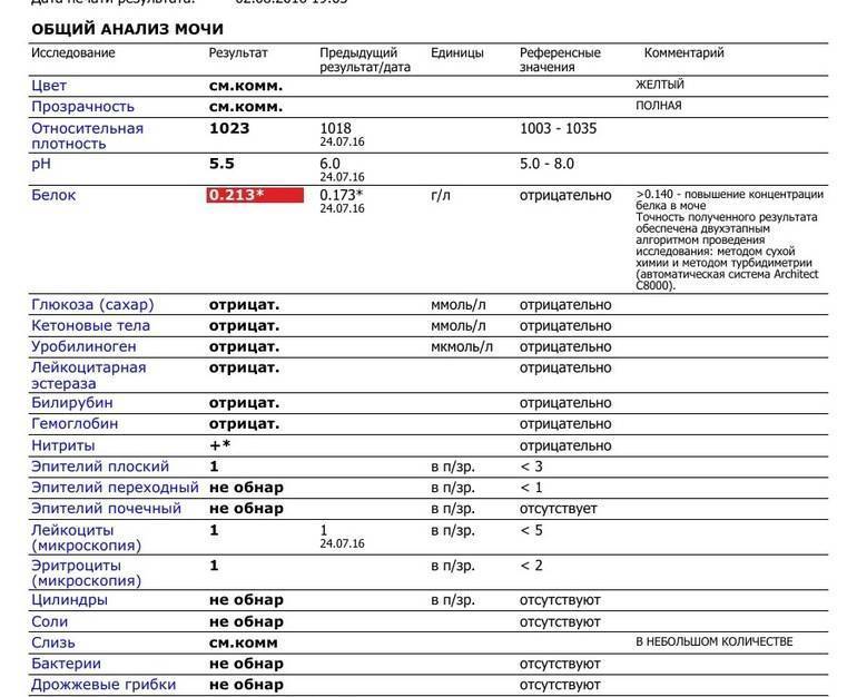 Общий анализ мочи - показатели, нормы * клиника диана в санкт-петербурге