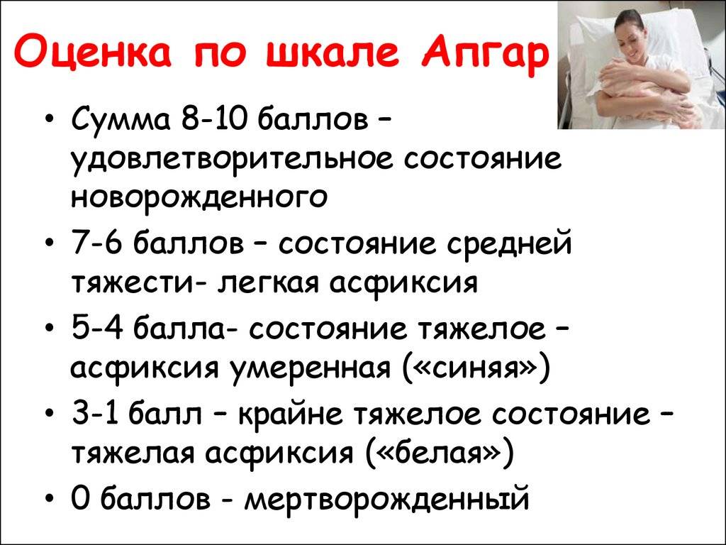 Шкала апгар: точная оценка состояния новорожденного