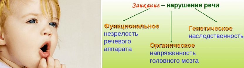 Заикание у детей: формы, причины, способы лечения