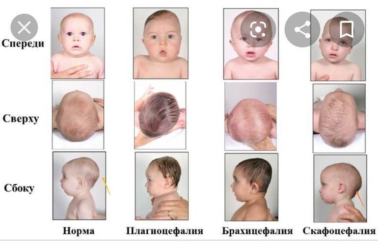Увеличение лимфатических узлов у детей – показатели нормы, диагностика и лечение | детская иммунология см-клиники в санкт-петербурге