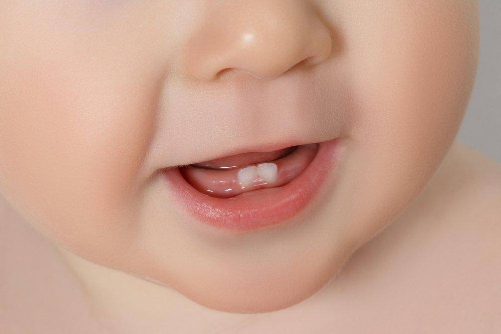 Когда появляются первые зубы у младенцев - 95 фото признаков и методов как прорезываются зубы