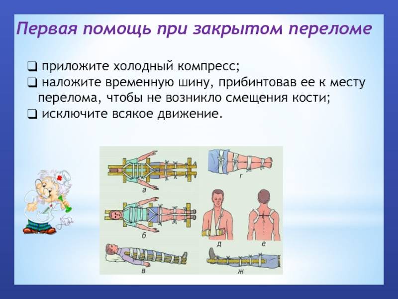 Лечение переломов