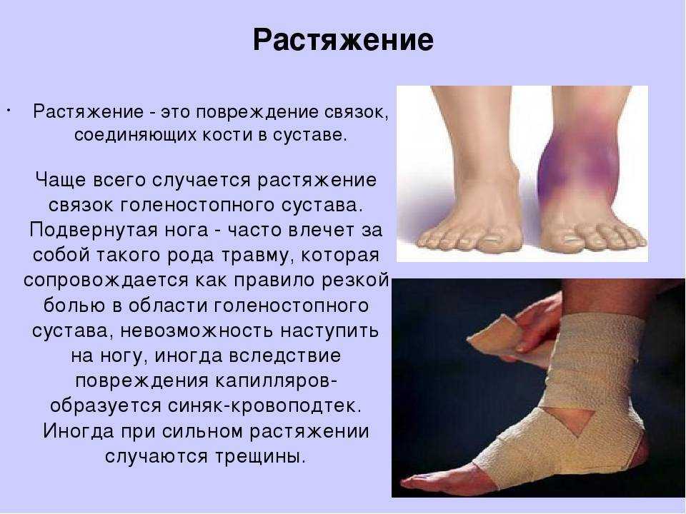 Если у ребенка вывих: как распознать, чем помочь и от чего воздержаться